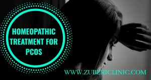 PCOS treatment in homeopathy Pakistan